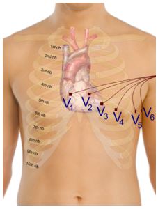 Precordial